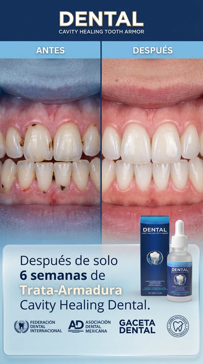 Dental Cavity Healing Tooth Armor S
